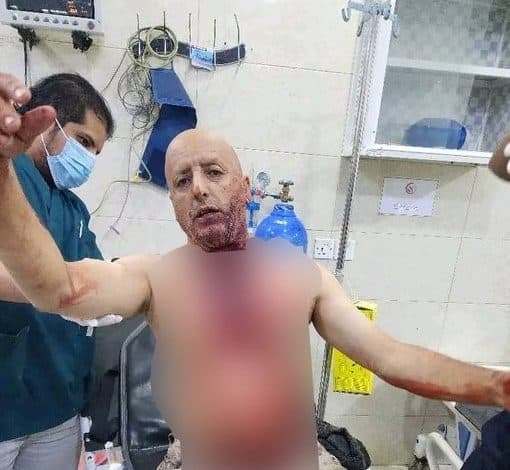 عصابة تذبح تاجر عسل في مدينة مارب وتنهب سيارته وبضاعته وتلوذ بالفرار