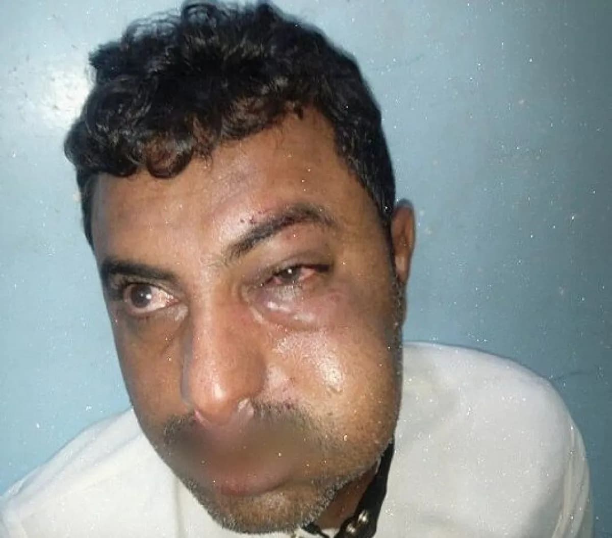 اعتداء قيادي حـ,ـوثي على محامٍ في الحديدة يثير استياءً واسعاً