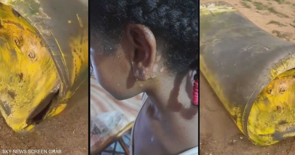 تحقيق خاص لسكاي نيوز عربية يتتبع جرائم الكيماوي في السودان