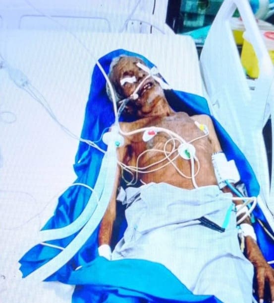 وفاة مسن بعد الاعتداء عليه في الجراحي بالحديدة بزعم الإفطار في رمضان