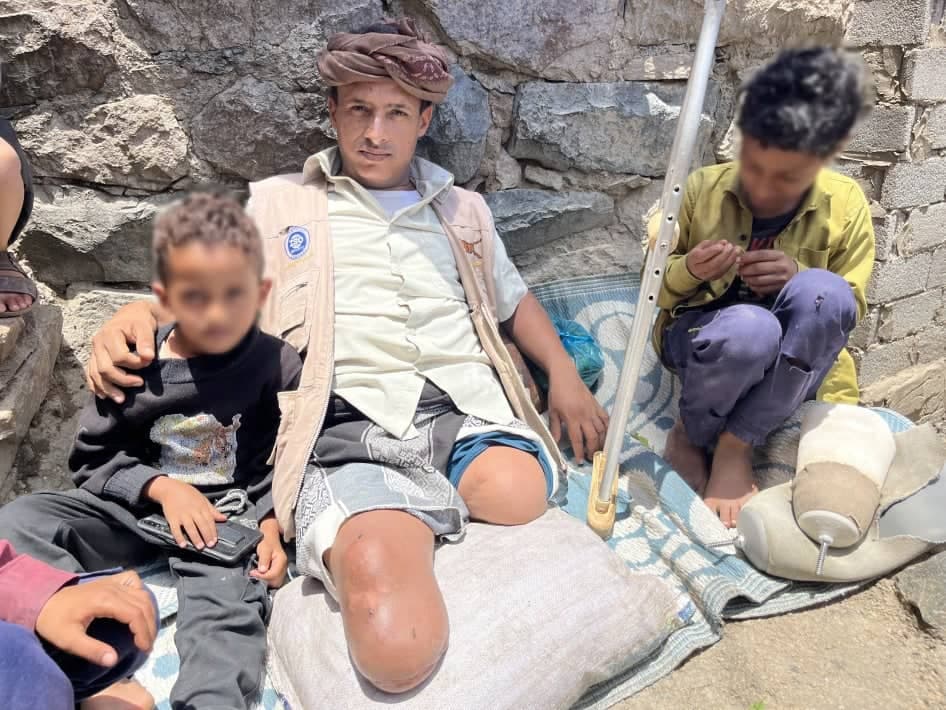 اليمن تحت قصف الألغام: نحو ألفي مدني مصرون وثلثهم أطفال